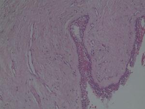 Histologic feature of biopsy specimen (Haematoxylin–eosin stain) – 20×.