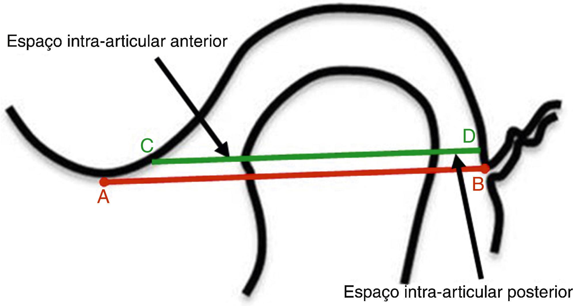 Relações maxila e mandíbula em dentados 