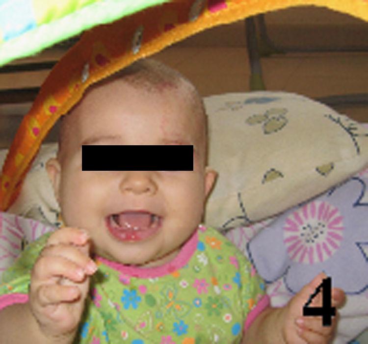 Donde Puedo Comprar Propranolol