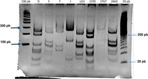 Polimorfismos de longitud de fragmentos de restricción del gen ompA en cepas de C. trachomatis aisladas de muestras de aspirado bronquial de recién nacidos con distrés respiratorio. Tipo de cepa (D, E, F, I); muestra de aspirado bronquial (2295, 2767, 2669), marcador de peso molecular (100 pb y 20 pb).