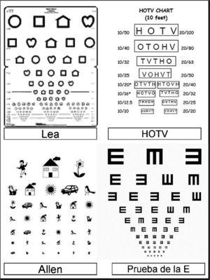 Distintos optotipos para la evaluación de la agudeza visual.