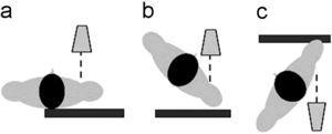 a) Proyección anteroposterior. b) Proyección tangencial. c) Proyección «Y».