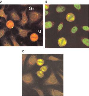 Patrones de anticuerpos que reconocen antígenos del aparato mitótico: A) anticuerpos anticentriolo (la fotografía muestra células HEp-2 en diferentes fases del ciclo celular, G2=Fase G2; M=Metafase); B) patrón NuMA-1, y C) patrón NuMA-2.