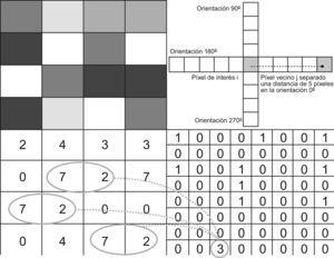 Construcción de la matriz de concurrencia del nivel de gris. En la parte superior izquierda se representan los píxeles de una imagen con un nivel de gris (imaginario) representado en la imagen inferior izquierda. Se computan las coincidencias para una pareja de píxeles dada (separados entre ellos por una distancia d y con un ángulo θ): el algoritmo cuenta cuántas veces se repiten los niveles de gris de la pareja de píxeles y construye la matriz de probabilidades de aparición de dicha pareja en la imagen. Es sobre esa matriz sobre la que se calculan las variables texturales (para los fundamentos teóricos véase Haralick et al, 1973)4.