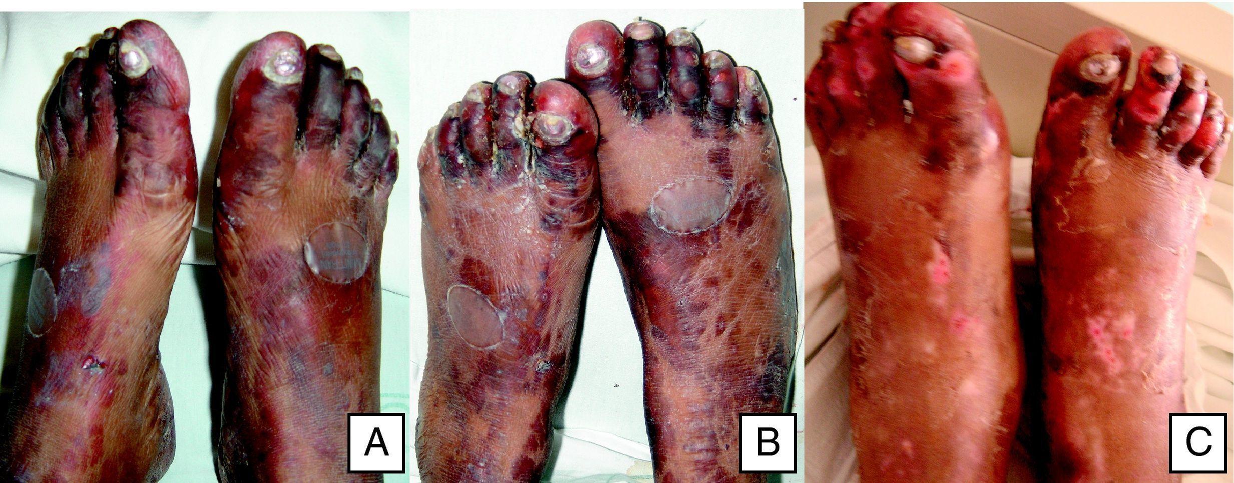 Sildenafilo 75mg online