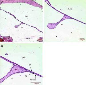 Histological section images of rat TM 14 days after traumatic perforation, stained with HE. EAC, external auditory canal; m, malleus handle; ep, epithelial layer; LP, lamina propria; mucosa, mucosal layer. Image (A) shows a magnification of 40×; (B) 100× and (C) 200×.