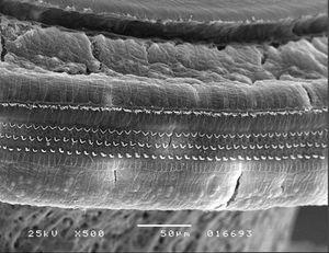 Photo from Sound group (scanning electronic microscopy), depicting no injuries to outer hair cells, 500× magnification.