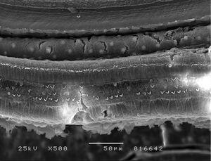 Photo from Expt group (scanning electron microscopy), 500× magnification.