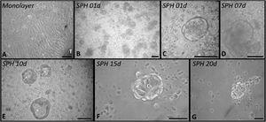 Phase contrast images of nasal polyp-derived cells. (A) Cells spreading from a tissue fragment (T) forming a monolayer of cells. (B–G) 3D cell culture (spheroids), the sequence of images shows the dynamics of spheroid formation from day 1 (B) keeping viable until the 20th day of culture (G). In the spheroids from the 10th day (E) it was observed in some cell aggregates the formation of a cavity in the medullary region (arrows). CS, columnar cells; Barr 50 µm.
