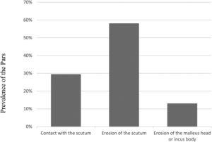 Prevalence of isolated retractions in the pars flaccida (atticus).