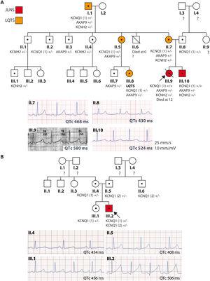 Family trees and electrocardiographic recordings of the families. Family tree (upper panel) and resting ECG recordings in lead II (lower panel) of the members of families 1 (A) and 2 (B). Red, JLNS; orange, LQTS; white, normal phenotype; •, carrier; ?, not studied; arrow, proband; KCNQ1 (1), c.604 + 1G>C variant; KCNQ1 (2), c.1513_1514delCA; JLNS, Jervell and Lange-Nielsen syndrome; LQTS, long QT syndrome.