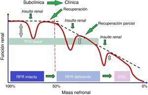 Relación entre RFR y TFG basal.El TFG basal puede diferir significativamente cuando la masa renal es mayor del 50%, gracias a la existencia de la RFR, pero cuando la masa renal es menor del 50%, la TFG presenta un deterioro progresivo, con una recuperación parcial de la RFR.ERC: enfermedad renal crónica; RFR: reserva funcional renal; TFG basal: tasa de filtración glomerular basal.