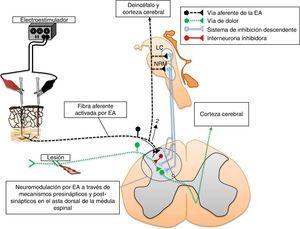 Mecanismos involucrados en la neuromodulación de la eficacia sináptica en el asta dorsal de la médula espinal: 1) despolarización de aferentes primarios; 2) activación de las vías de inhibición descendente. EA: electroacupuntura.
