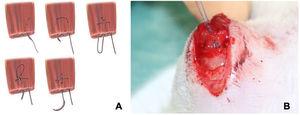 A) Ilustración de la sutura tipo Mason-Allen modificada18. B) Imagen de la cirugía, sutura tipo Mason-Allen modificada sobre el tendón supraespinoso de la rata.