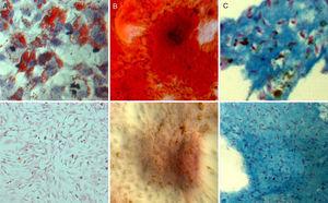 Multipotency of SPIO-labelled ADMSCs. (A) Adipogenic differentiation. Oil Red O staining. (B) Osteogenic differentiation. Alizarin red staining. (C) Chondrogenic differentiation. Alcian blue staining. Bottom photos: negative controls for each of the techniques.