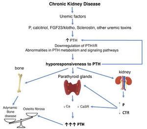 Potential time sequence and consequences of hyporesponsiveness to PTH in CKD. With the development of chronic kidney disease (ie decreased glomerular filtration), factors related to the loss of kidney function (for example the classic phosphorus overload and/or decreased calcitriol) together with factors (known or yet unknown) associated with "uremia" itself, would lead to an increase in PTH. These, together with alterations in PTH metabolism, interferences in its signaling pathways and/or downregulation of its receptors, would condition additional increases in PTH due to its abnormally diminished response. By different mechanisms, the less calcemic response to the action of PTH, the more hormone is necessary to restore calcium levels to normal (greater synthesis and secretion of PTH, as well as greater need for cell proliferation). Likewise, new vicious cycles would be created at the kidney level and imbalances in the bone depending on whether anabolic or inhibitory elements prevail. Osteitis fibrosa is the bone expression of secondary hyperparathyroidism (high turnover bone disease) and adynamic bone disease is the result of low bone turnover. CTR: calcitriol; FGF-23: Fibroblast Growth Factor 23; P: phosphorus; PTH1R: parathyroid hormone receptor (PTH); CaSR: calcium sensing receptor (adapted from Bover et al.148).