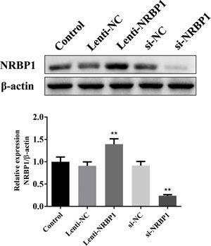 Efficiency of NRBP1 transfection and silencing was confirmed by western blot. (χ¯±s,n=3), *P<0.05, **P<0.01 vs. Control group.