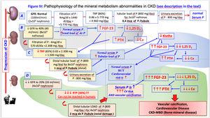 Pathophysiology of the mineral metabolism abnormalities in CKD.