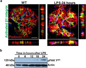 LPS activates podocyte β1 integrin and FAK in vivo. (a) Frozen kidney sections from control and LPS-treated mice were stained using an antibody against activated β1 integrin. Podocin was used a podocyte marker. Activated β1 integrin expression colocalized with podocin 24h following LPS, but not at baseline. N=3–5 per group. Imaged were captured at 60×. Scale bars: 100μm. (b) By western blot of glomerular lysates, phosphorylated FAK was upregulated 24h following LPS. N=3 per group. WT, wild-type mice (controls).