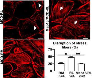 MCD sera in relapse mediate podocyte injury via β1 integrin signaling. Sera from children with MCD in relapse (RL) leads to actin rearrangement (arrowheads) compared to sera in remission (RM). N=4 per group. *p=0.02. Mab13 prevents changes in actin stress fibers (white arrows) in podocytes cultured with MCD sera in relapse. N=3. **p=0.04. Scale bars: 100μm. Data presented as mean±S.D. MCD, minimal change disease.