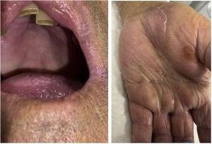 Disappearance of lesions 20 days after administering contrast.