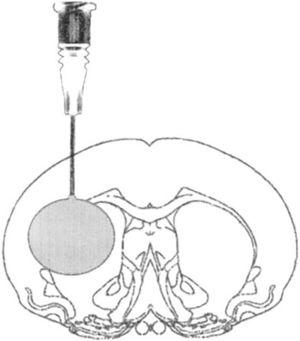 Model of intracranial hypertension due to space occupying lesion in a rat after craniotomy procedure.