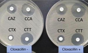 Extended-spectrum beta-lactamase (ESBL)-producing Klebsiella pneumoniae. In usual medium (without cloxacillin), the halos of ceftazidime (CAZ) and cefotaxime (CTX) are seen to be of smaller diameter than those of both cephalosporins combined with clavulanic acid (CCA and CTT, respectively). In medium with cloxacillin, which would inhibit the eventual additional presence of a class C beta-lactamase - plasmidic in the case of K. pneumoniae - no increase in the halos is observed, thus discarding this possibility.