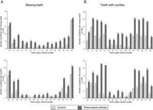 Distribution of tooth absences (A) and cavities (B) in patients with RA and without RA.
