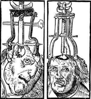 Mediaeval trepanation.
