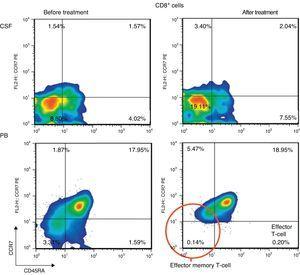 Distribution of CD8+ T cell subsets in CSF and peripheral blood before and after treatment with intravenous immunoglobulins (IVIg) and rituximab (RTX). Quadrant numbers show percentages of the total lymphocyte count.