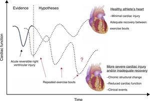 Potential effects of repeated exercise bouts on RV function.