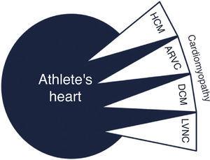 Overlap between cardiomyopathy and athlete's heart. ARVC: arrhythmogenic right ventricular cardiomyopathy; DCM: dilated cardiomyopathy; HCM: hypertrophic cardiomyopathy; LVNC: left ventricular noncompaction.