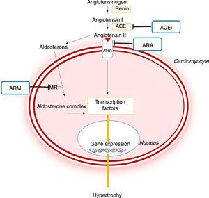 Importance of the renin-angiotensin-aldosterone system in the pathophysiology of hypertrophic cardiomyopathy and mechanism of action of different pharmacological inhibitors of this system.44,45 ACE: angiotensin-converting enzyme; ACEi: angiotensin-converting enzyme inhibitor; ARB: angiotensin receptor blocker; AT1R: angiotensin II receptor type I; CaMKII: Ca2+/calmodulin-dependent protein kinase II; JAK: Janus kinase; MEF2: myocyte enhancer factor 2; MRA: mineralocorticoid receptor antagonist; NF-κB: nuclear factor kappa B; MR: mineralocorticoid receptor; STAT: signal transducer and activator of transcription.