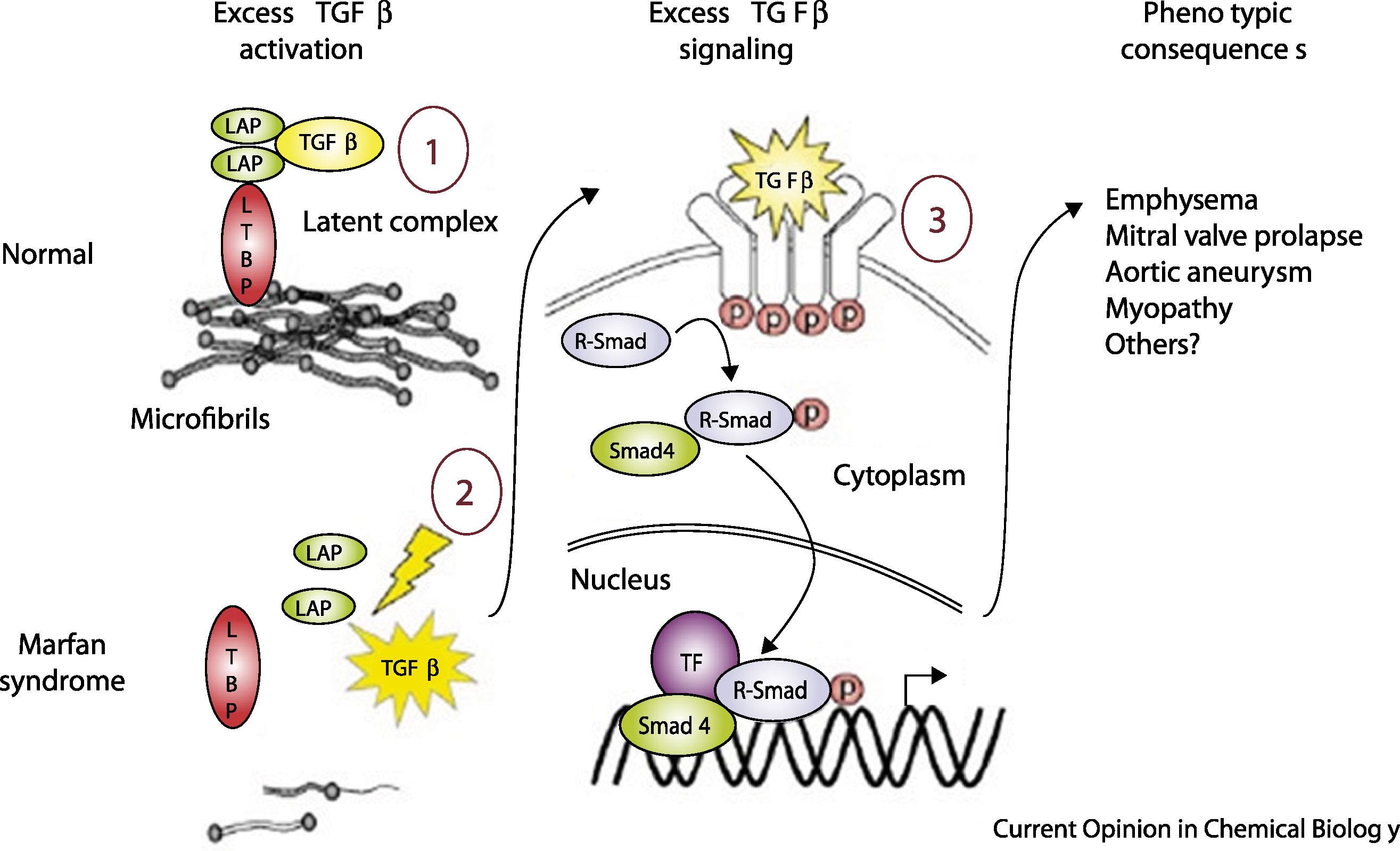 Molecular Mechanisms in Genetic Aortopathy–Signaling Pathways and Potential  Interventions