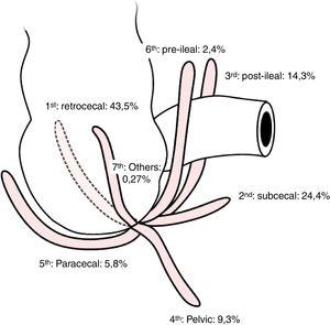 Positions of the vermiform appendix.