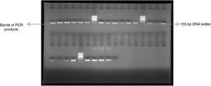 Qualitative results analysis of PCR of APC gene on 1.5% agarose gel electrophoresis, 100 bp ladder was used for purpose of comparison with 155 bp.