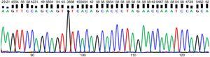 Results of sampling of bp and chromatogram of rs41115 polymorphism in APC gene of a patient with CRC.