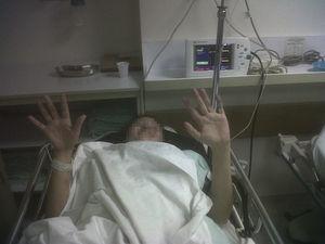 Picture of the patient showing the hands after the administration of the first test dose. Source: authors.