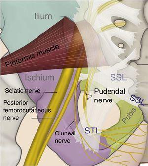 Relationship of the sacrospinous (SSL) and sacrotuberous (STL) ligaments (made transparent in order to show the deep structures), and the course of the pudendal, sciatic and posterior femorocutaneous nerves.
