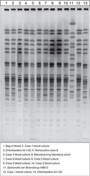 Pulsed-field gel electrophoresis patterns of the strains involved in the outbreak.