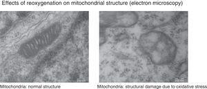 The images show morphological and structural changes including structural disruption, swelling, loss of cristae, membrane rupture and finally vacuolation and destruction of cerebral mitochondria in a model where newborn mice were exposed to different oxygen concentrations. Courtesy of Isabel Torres-Cuevas (doctoral thesis; supervisor: Máximo Vento).
