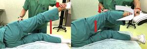 Test de valoración del tensor de la fascia lata. Con resistencia del explorador el paciente eleva su cadera lateralmente con extensión y con flexión de la rodilla. La disminución del dolor en flexión indica dolor de la fascia lata.