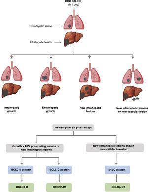 Prognostic value of the progression patterns. The progression pattern in first-line treatment with sorafenib is a prognostic factor in patients with hepatocellular carcinoma (HCC). Patients who develop new extrahepatic lesions have a lower survival rate than those with other patterns. According to the baseline stage and the progression pattern, different prognostic groups are established, known as the BCLC (Barcelona-Clinic-Liver-Cancer) classification after progression (BCLCp). BCLCp-B defines radiological progression due to the growth of existing liver nodules or new intrahepatic foci, but the patient is still in intermediate stage (BCLC B) due to the absence of vascular invasion or extrahepatic spread. Patients with radiological progression and progressing to advanced stage (BCLC C) or progressing within BCLC C are divided into BCLCp-C1 (growth of pre-existing nodules or new intrahepatic sites) and BCLCp-C2 (progression by a new extrahepatic lesion and/or or vascular invasion). Adapted from Bruix et al.201