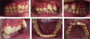 Initial intraoral photographs.