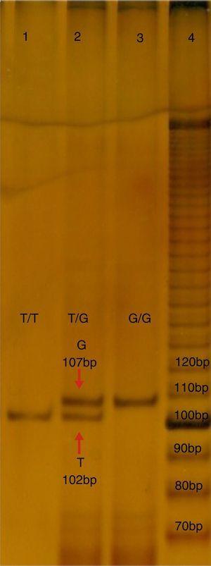 Electrophoresis in polyacrylamide at 7%, TBE 0.5X, of the PCR-PASA for the SNP rs2291166 of TJP1. Lane number 4 corresponds to the running of the marker of 10 bases (life-technologies). Lane 1 and 3 correspond to the sample of homozygote subjects T and G, lane 2 corresponds to a herterozygote. Bp: pairs of bases.