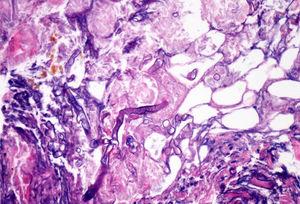 H&E staining. A large non-partitioned and thick hypha is shown.