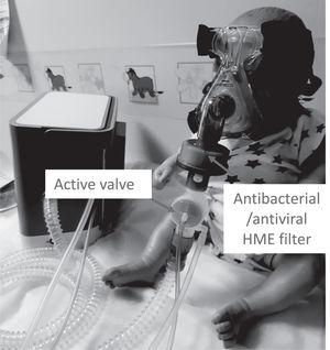 Picture shows a child mannequin wearing a non–vented nasal mask with the active valve circuit set up. Note the position of the HME and active valve in the circuit. The same set-up can be used for a face mask or a total face mask.