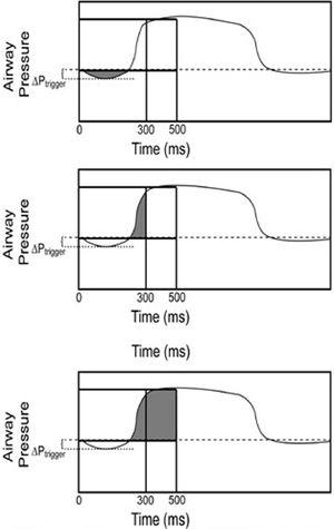Inspiratory pressure-time product (PTP), PTP at 300 ms, and PTP at 500 ms on the pressure/time trace.