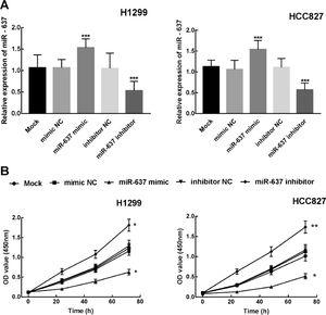Inhibitory effect of miR-637 on NSCLC cell proliferation. A. The expression level of miR-637 in H1299 and HCC827 cells after cell transfection. ***P < 0.001. B. The proliferation of NSCLC cells with overexpression or knockdown of miR-637. *P < 0.05, **P < 0.01.