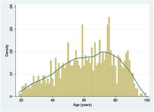 Histogram of age distribution with Kernel density plot.